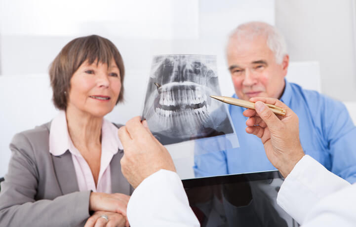 Benefits of Root Canal Treatment